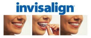 invisalign_header