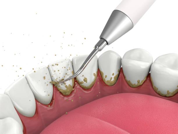 Professional dental checkup at Hill Park Dental